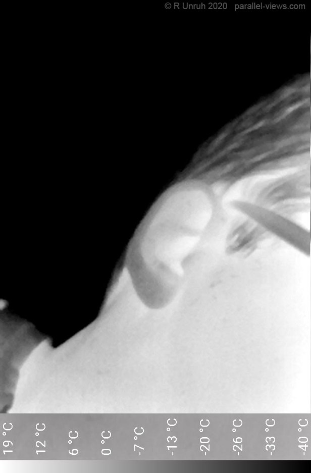 PRO_SELFIE, Android 8.1.0